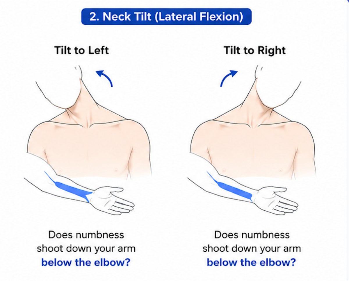 Neck-turn test — lateral tilt